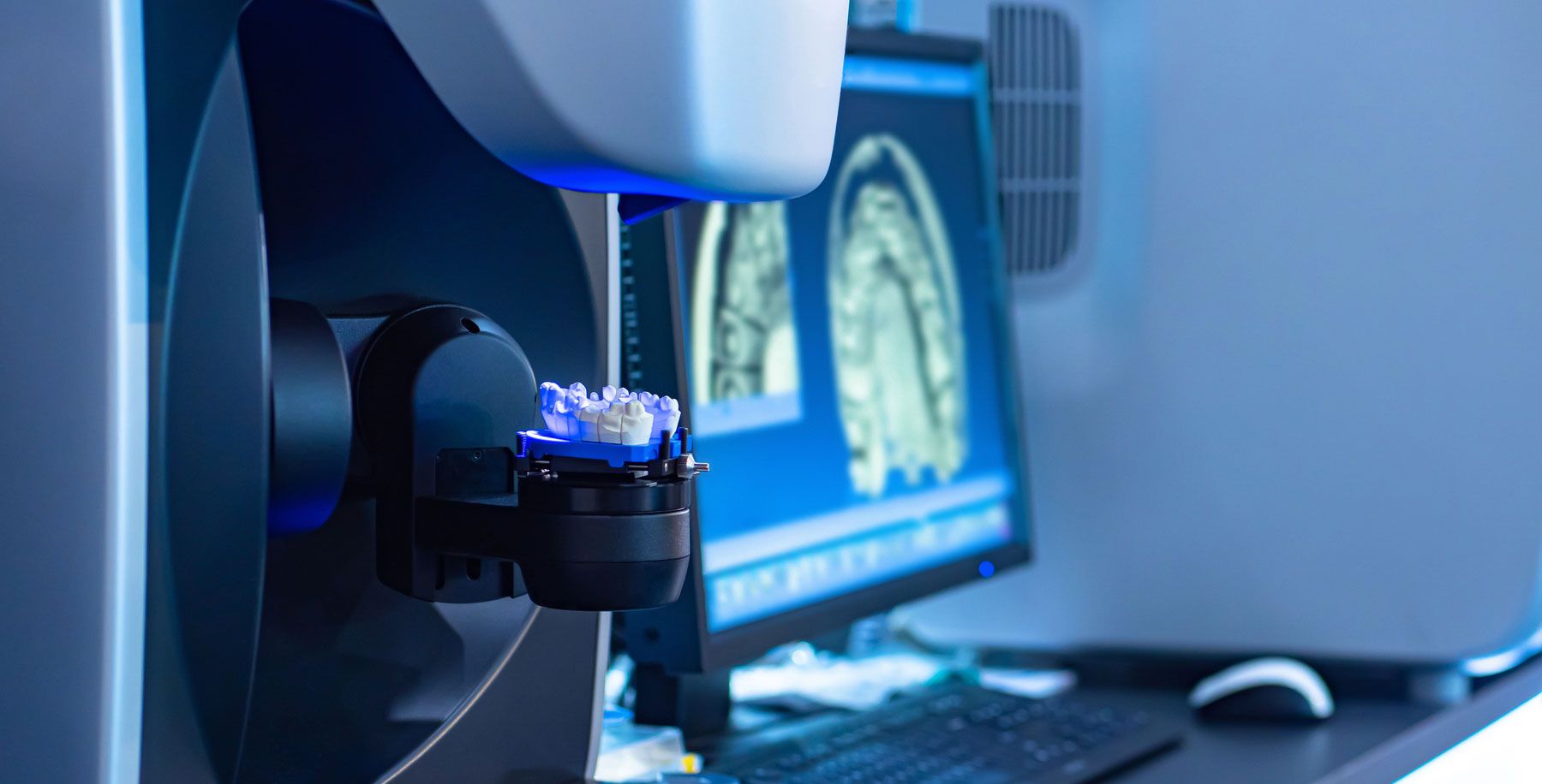 CEREC® - The Latest in Dental Technology