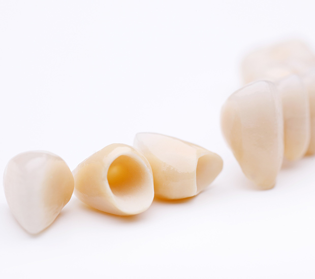 Red Bluff Dental Crowns and Dental Bridges