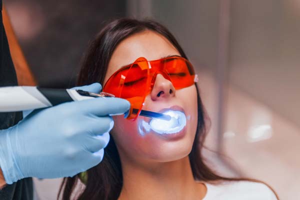 Can A Dental Filling Be Replaced?