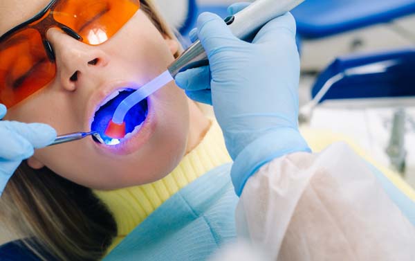 Signs You May Need A Dental Filling