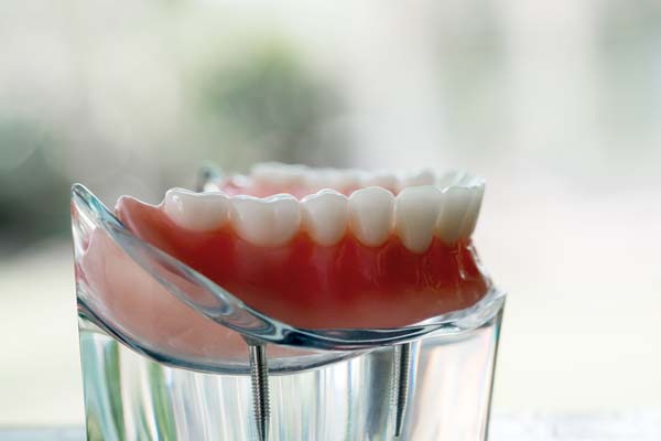 Dentures To Replace Missing Teeth And Gums