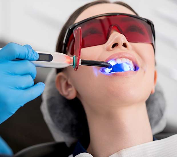 Red Bluff Professional Teeth Whitening